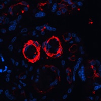 Anti-MYT1 Antibody