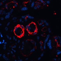 MYT1 antibody