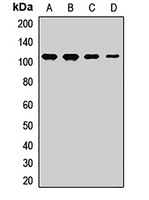 EZH2 Rabbit Polyclonal Antibody