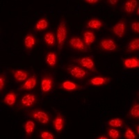 Anti-EZH2 Antibody