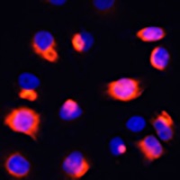 Anti-HO-1 Antibody