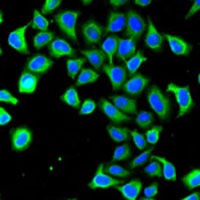 Anti-NGAL Antibody