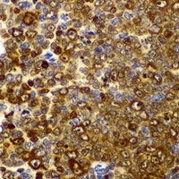 Anti-CD282 Antibody