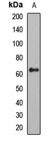 SQSTM1 Rabbit Polyclonal Antibody