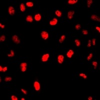 Anti-MCM7 Antibody