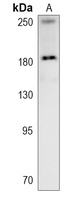 ZO1 Rabbit Polyclonal Antibody