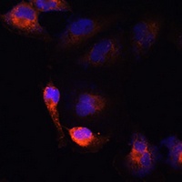 Anti-BACE1 Antibody