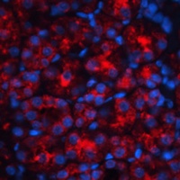 NGAL Rabbit Polyclonal Antibody
