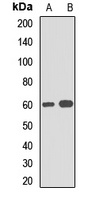 SQSTM1 Rabbit Polyclonal Antibody