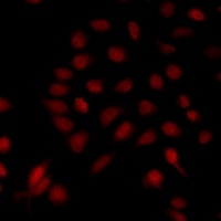 Anti-MAD1 Antibody