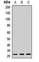 RAB7A Rabbit Polyclonal Antibody