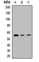 GABRA3 Rabbit Polyclonal Antibody