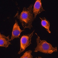 ZCCHC11 antibody