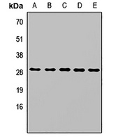 SPR Rabbit Polyclonal Antibody