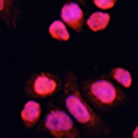 Anti-CHAMP1 Antibody