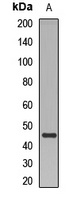 Beta-arrestin-2 Rabbit Polyclonal Antibody