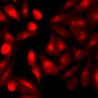 Anti-Beta-arrestin-2 Antibody