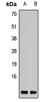 AKAP7 Rabbit Polyclonal Antibody