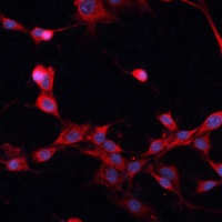 Anti-CD243 Antibody