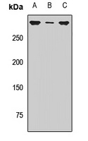 SETD2 Rabbit Polyclonal Antibody