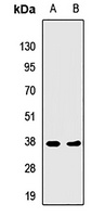HLA-DRA Rabbit Polyclonal Antibody