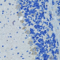 Anti-Nestin Antibody