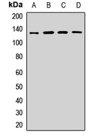 HIP1R Antibody