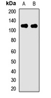 PIBF Rabbit Polyclonal Antibody
