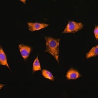 Anti-SPRR3 Antibody