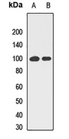 RANBP9 Rabbit Polyclonal Antibody
