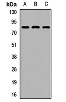 RIOK2 Rabbit Polyclonal Antibody