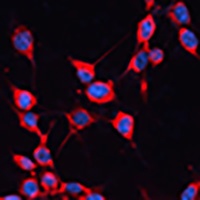 Anti-SCaMC-1 Antibody