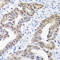 Anti-Sm F Antibody