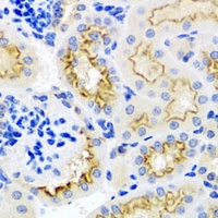 Anti-SRPX Antibody
