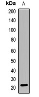 Adenylate Kinase 1 Rabbit Polyclonal Antibody