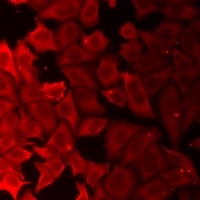 Anti-Adenylate Kinase 1 Antibody