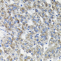 Anti-FUCA2 Antibody