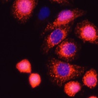 HRAS antibody