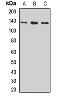 SPA-1 Rabbit Polyclonal Antibody