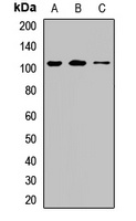 CIP2A Rabbit Polyclonal Antibody