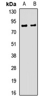 SNPH Rabbit Polyclonal Antibody