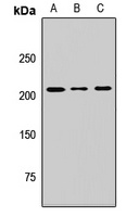 MTMR5 Rabbit Polyclonal Antibody