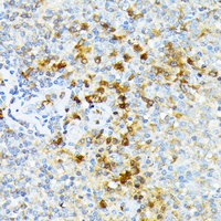 Spectrin alpha I Rabbit Polyclonal Antibody