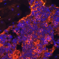 Spectrin alpha I Rabbit Polyclonal Antibody