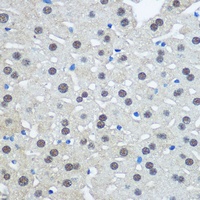 Anti-UBA1 Antibody