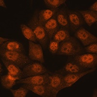 Anti-UBA1 Antibody