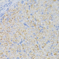 Anti-ACADL Antibody