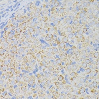 ACADL antibody