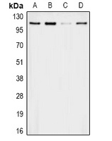 Apolipoprotein B Rabbit Polyclonal Antibody