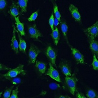 Apolipoprotein B Rabbit Polyclonal Antibody